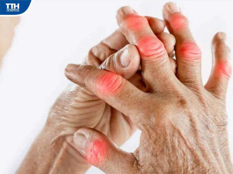 Bệnh đa khớp có nguy hiểm không?