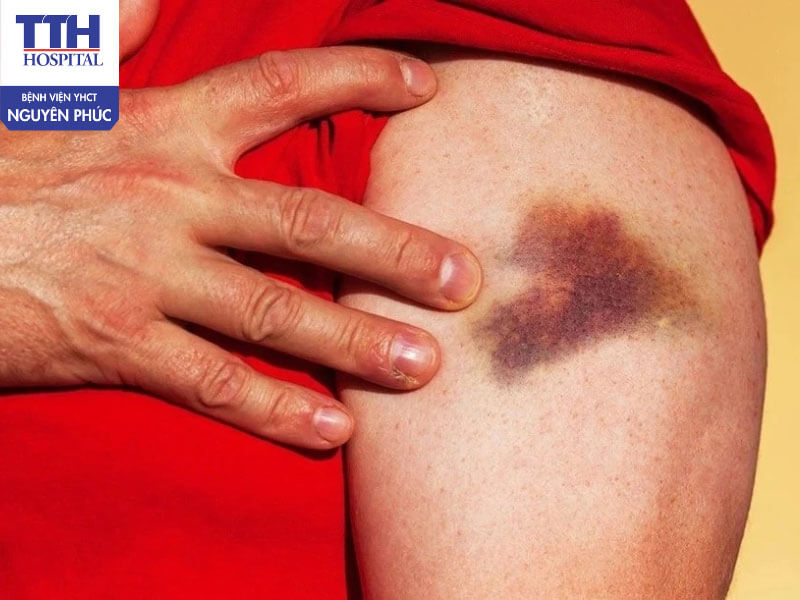 Biến chứng của bệnh đái tháo đường