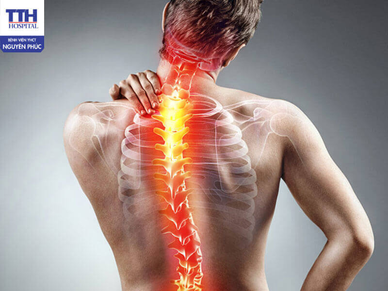 Các phương pháp hỗ trợ điều trị cong vẹo cột sống phổ biến hiện nay