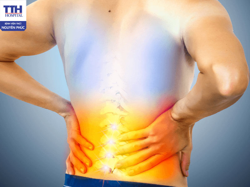 Cách phòng ngừa thoát vị đĩa đệm cho dân văn phòng