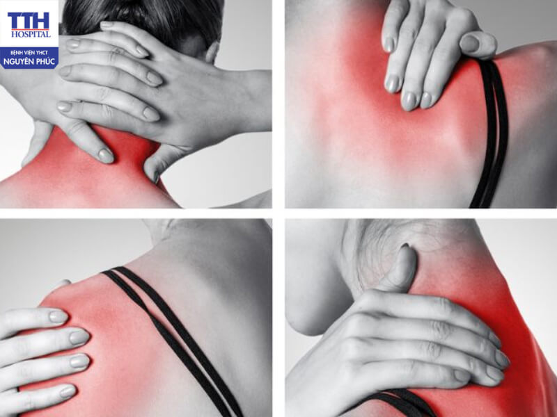 Cần đến bác sĩ chuyên khoa thăm khám nếu các triệu chứng đau vai gáy kéo dài trên 1 tuần