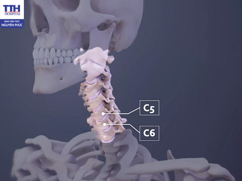 Cấu tạo cột sống cổ và đặc điểm đốt sống C5-C6