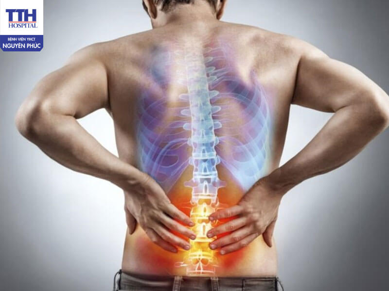 Chỉ điều trị khi đau nặng, bỏ qua giai đoạn sớm