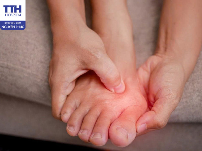 Chủ động kiểm soát Gout để mùa lễ hội cuối năm trọn vẹn và khỏe mạnh