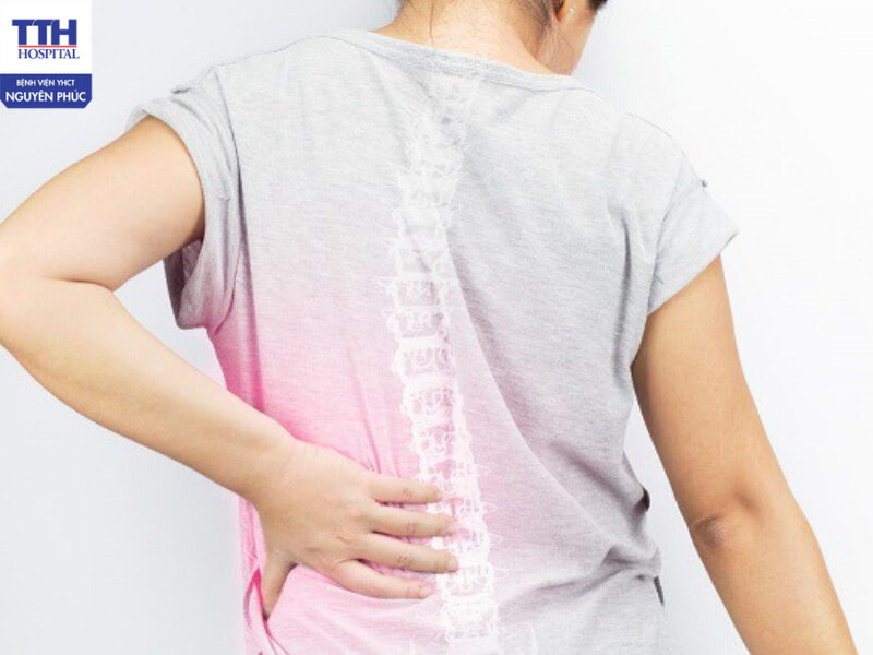 Đau thần kinh tọa là tình trạng đau do dây thần kinh tọa bị chèn ép hoặc kích thích