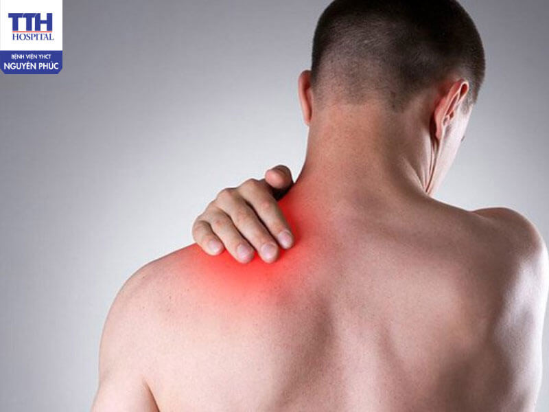 Đau vai gáy là gì?