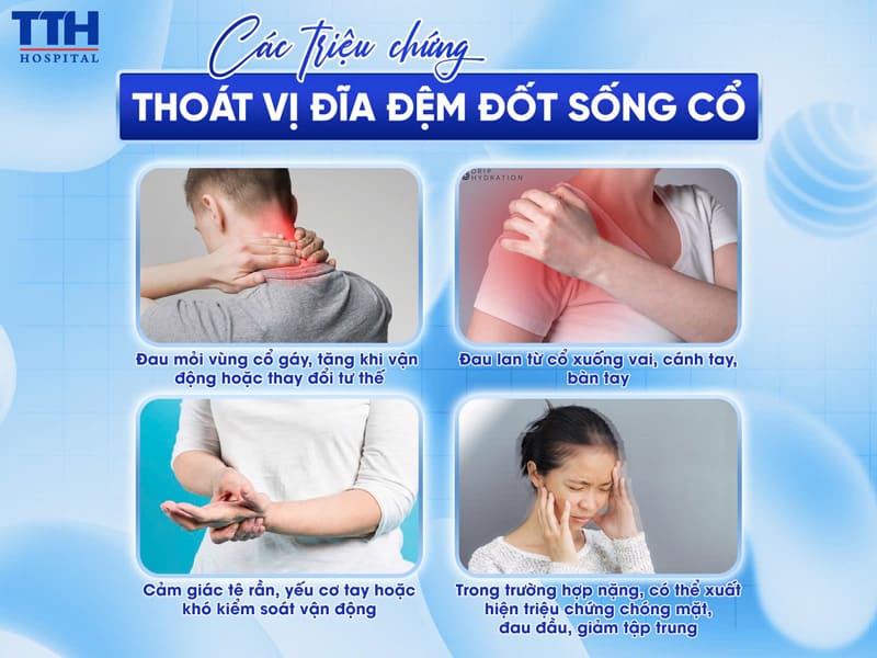 Điều Trị Thoát Vị Đĩa Đệm Cổ Tại Bệnh Viện YHCT Nguyên Phúc – Giải Pháp Đông Tây Y Kết Hợp