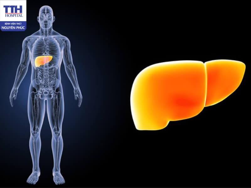 Gan nhiễm mỡ cần được phát hiện sớm để kịp thời điều trị