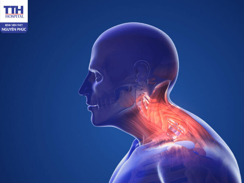 Hướng chăm sóc đau vai gáy theo y học cổ truyền