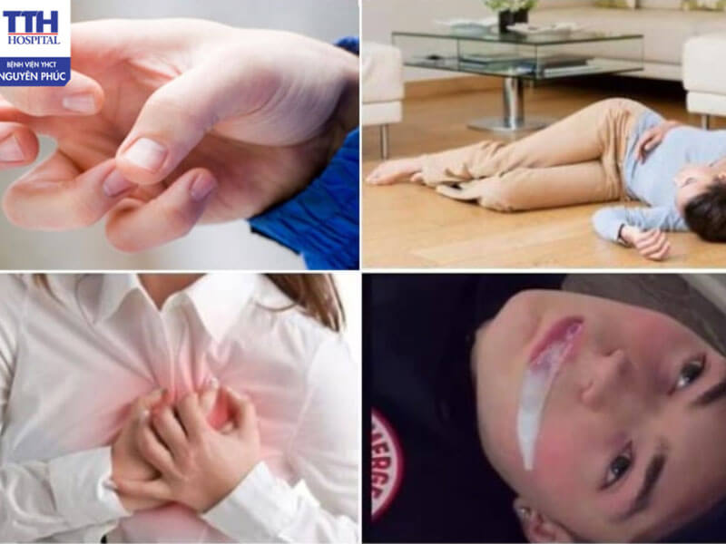 Hướng điều trị động kinh ở người lớn