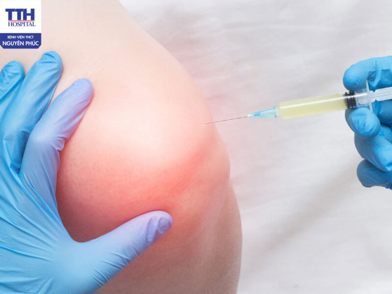 Để đạt hiệu quả tối ưu, tiêm chất nhờn dịch khớp nên đi kèm với các phương pháp khác hiệu quả