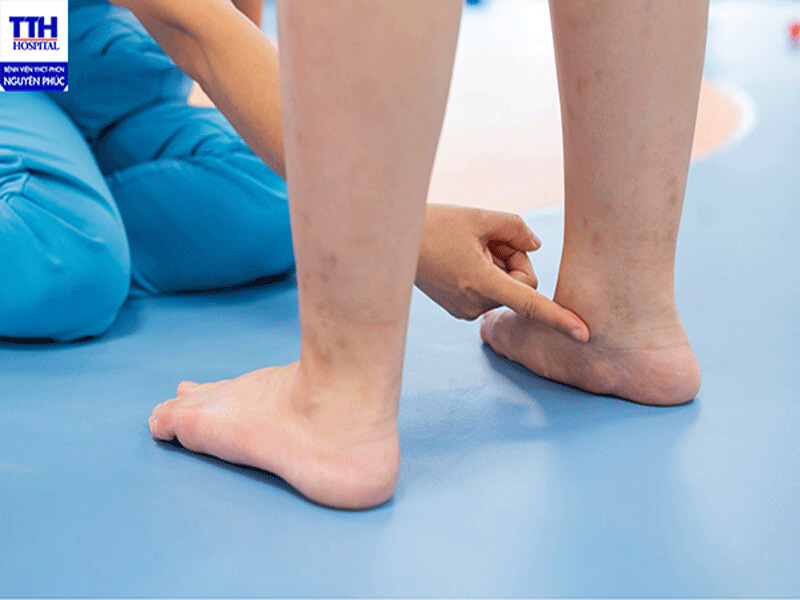 LỜI KHUYÊN TỪ CÁC BÁC SĨ KHOA PHỤC HỒI CHỨC NĂNG NHI BỆNH VIỆN Y HỌC CỔ TRUYỀN NGUYÊN PHÚC