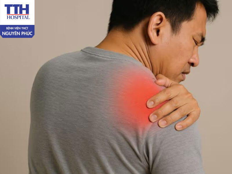 Nguyên nhân gây rách gân cơ chóp xoay vai