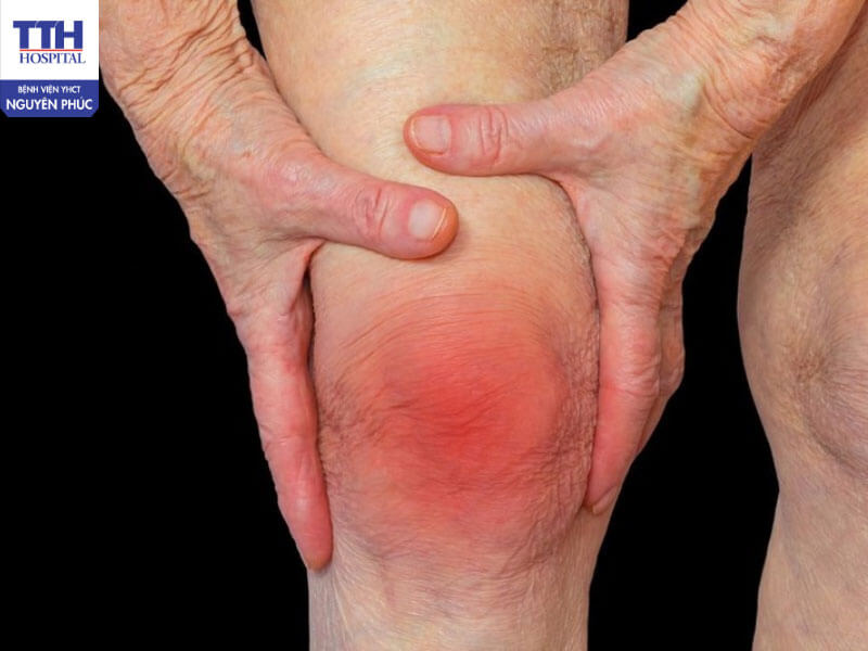 Rối loạn giấc ngủ, trầm cảm và suy giảm chất lượng sống