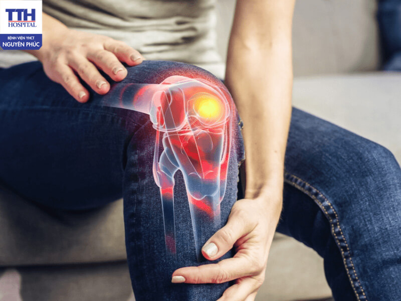 Thoái hóa khớp gối ảnh hưởng đến vận động và sinh hoạt hằng ngày