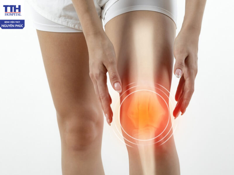 Thoái hóa khớp là quá trình tổn thương và mất dần cấu trúc của sụn khớp theo thời gian