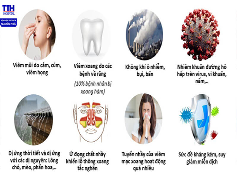 Viêm Mũi Xoang Là Gì?