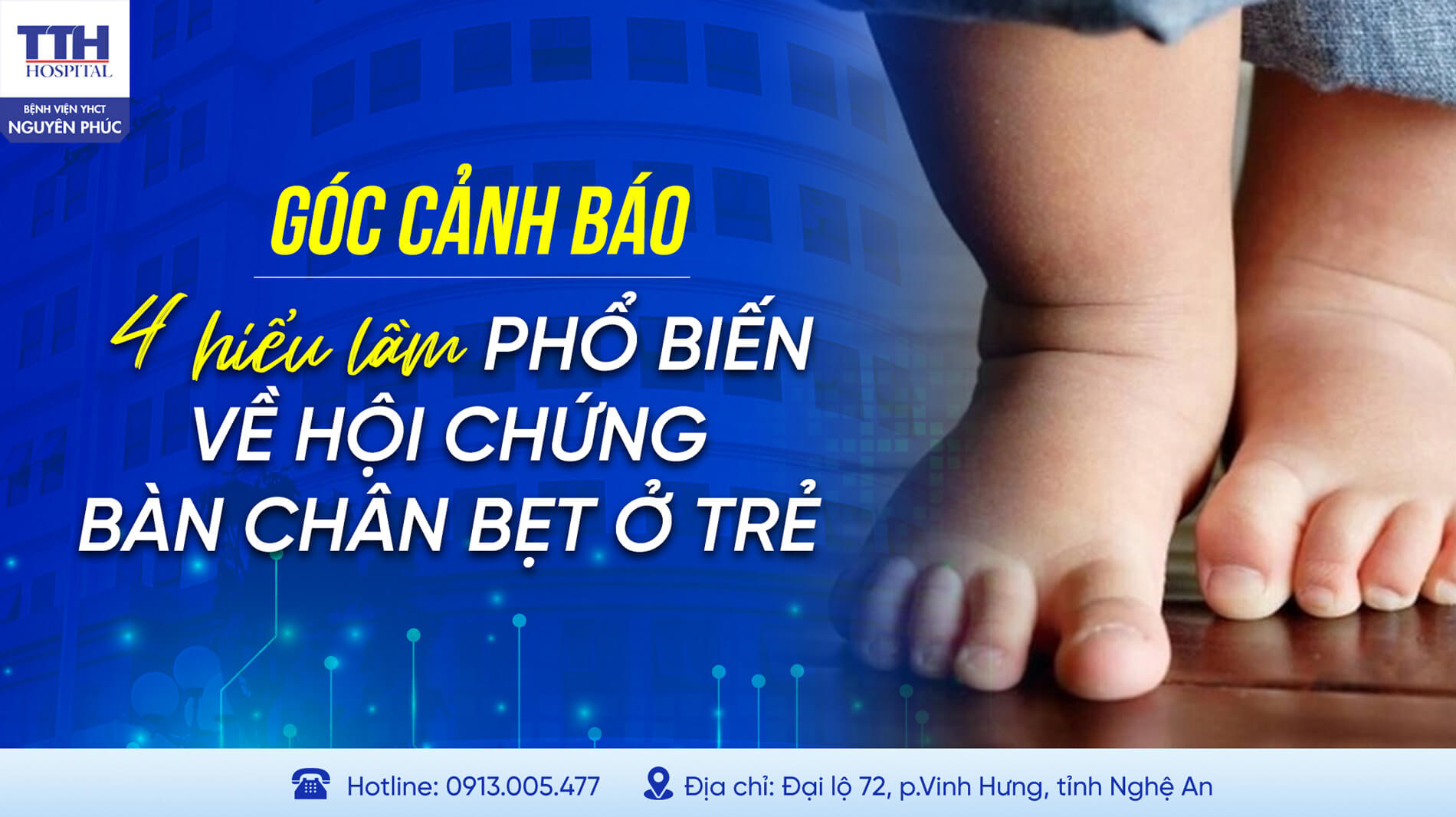 4 HIỂU LẦM PHỔ BIẾN VỀ HỘI CHỨNG BÀN CHÂN BẸT Ở TRẺ