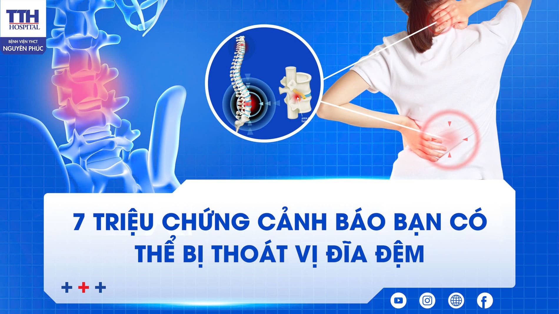 7 Triệu Chứng Cảnh Báo Bạn Có Thể Bị Thoát Vị Đĩa Đệm