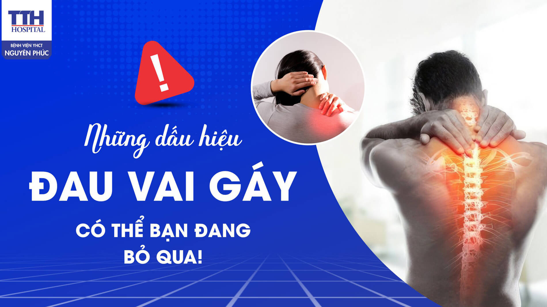 Cảnh báo: Những dấu hiệu đau vai gáy có thể bạn đang bỏ qua!