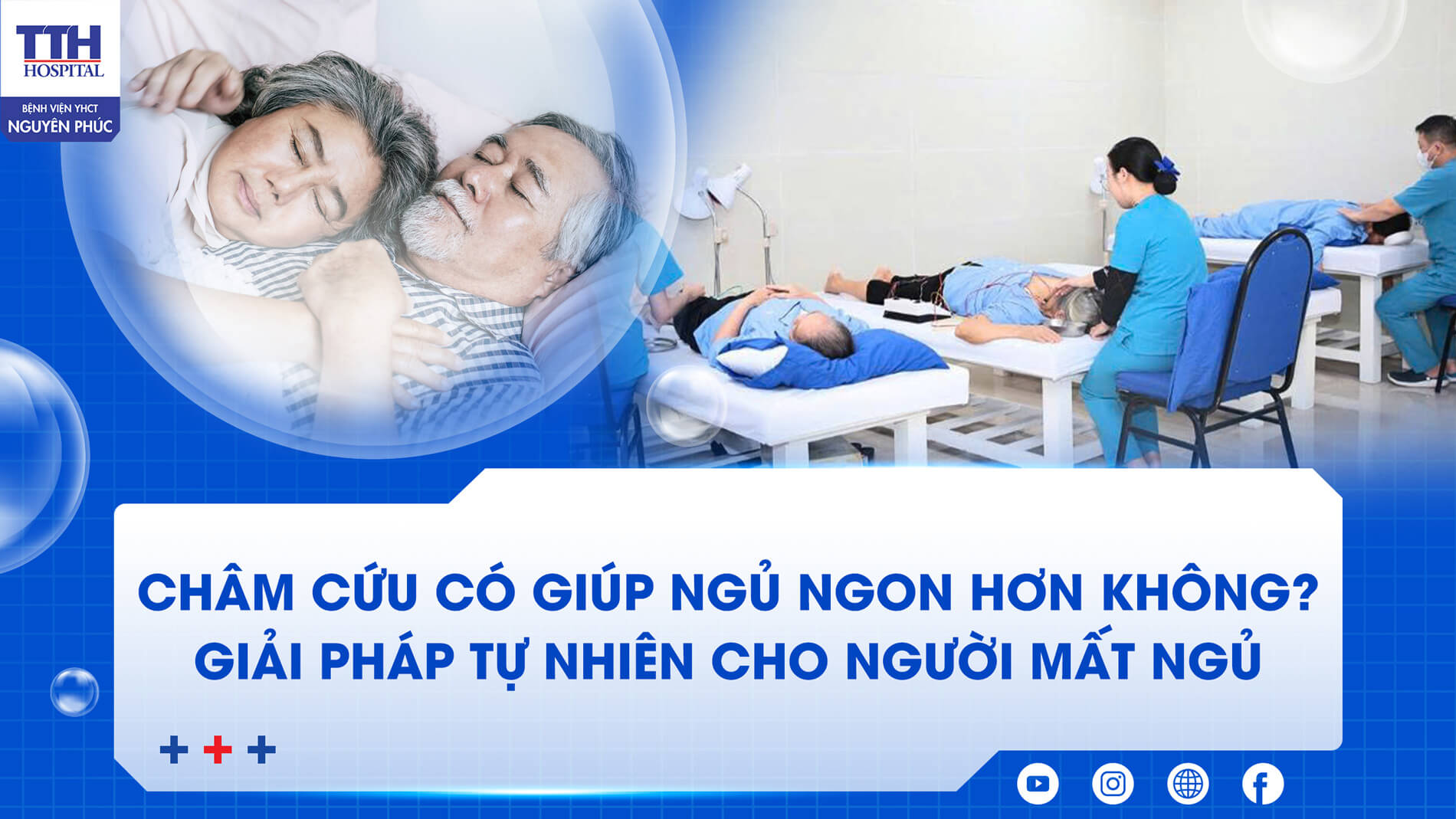 CHÂM CỨU CÓ GIÚP NGỦ NGON HƠN KHÔNG? 