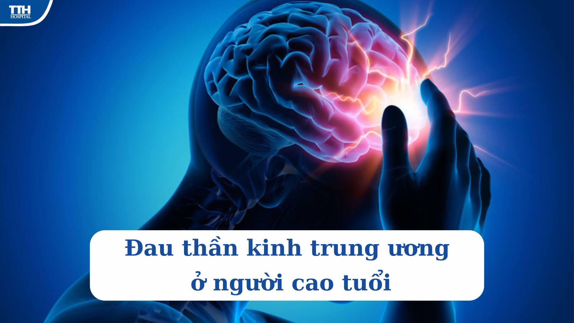 ĐAU THẦN KINH TRUNG ƯƠNG
