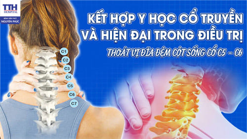 Kết Hợp Y Học Cổ Truyền Và Hiện Đại Trong Điều Trị Thoát Vị Đĩa Đệm Cột Sống Cổ C5-C6
