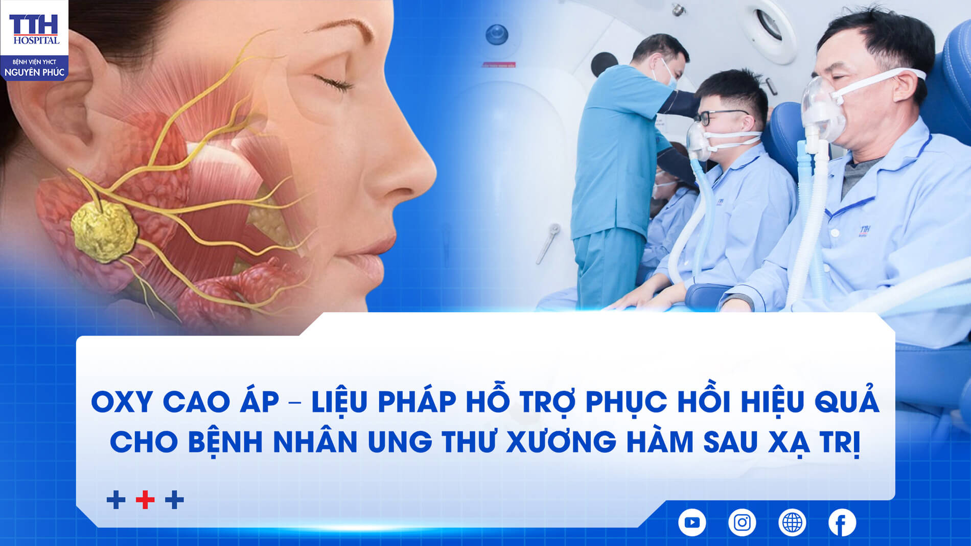 OXY CAO ÁP – LIỆU PHÁP HỖ TRỢ PHỤC HỒI HIỆU QUẢ