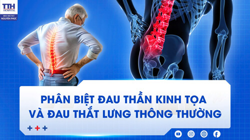 Phân Biệt Đau Thần Kinh Tọa Và Đau Thắt Lưng Thông Thường
