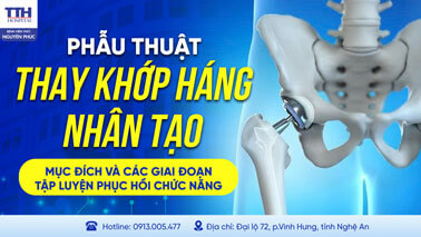 PHẪU THUẬT THAY KHỚP HÁNG NHÂN TẠO